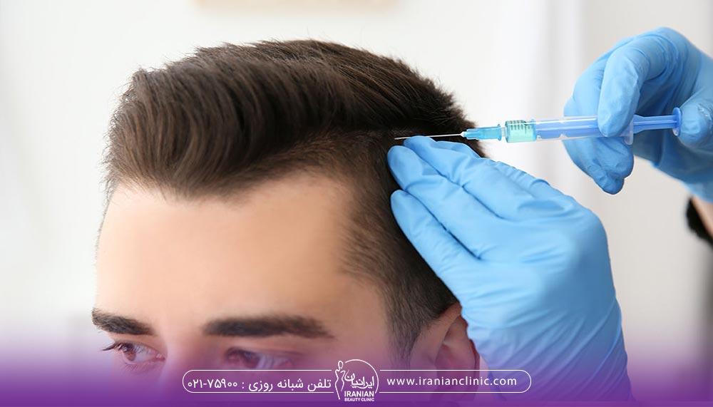 مزوتراپی مو