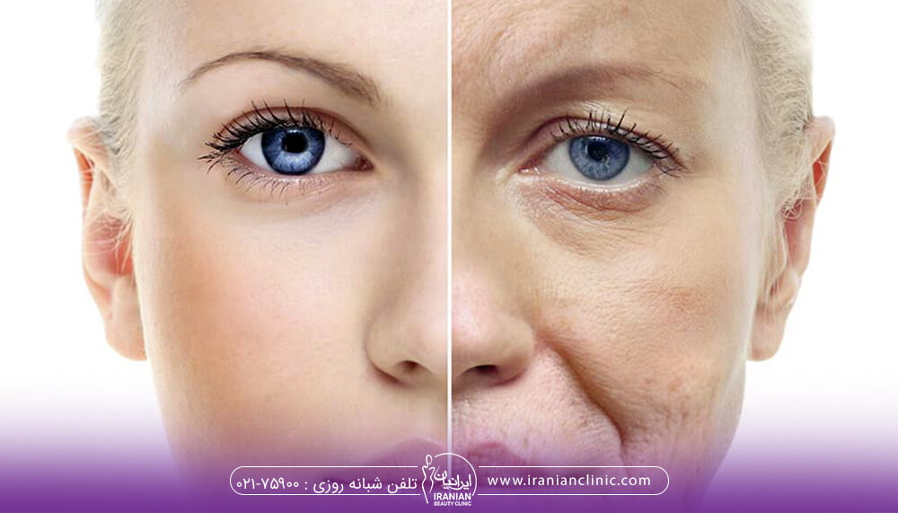 تاثیر مزوژل بر پوست