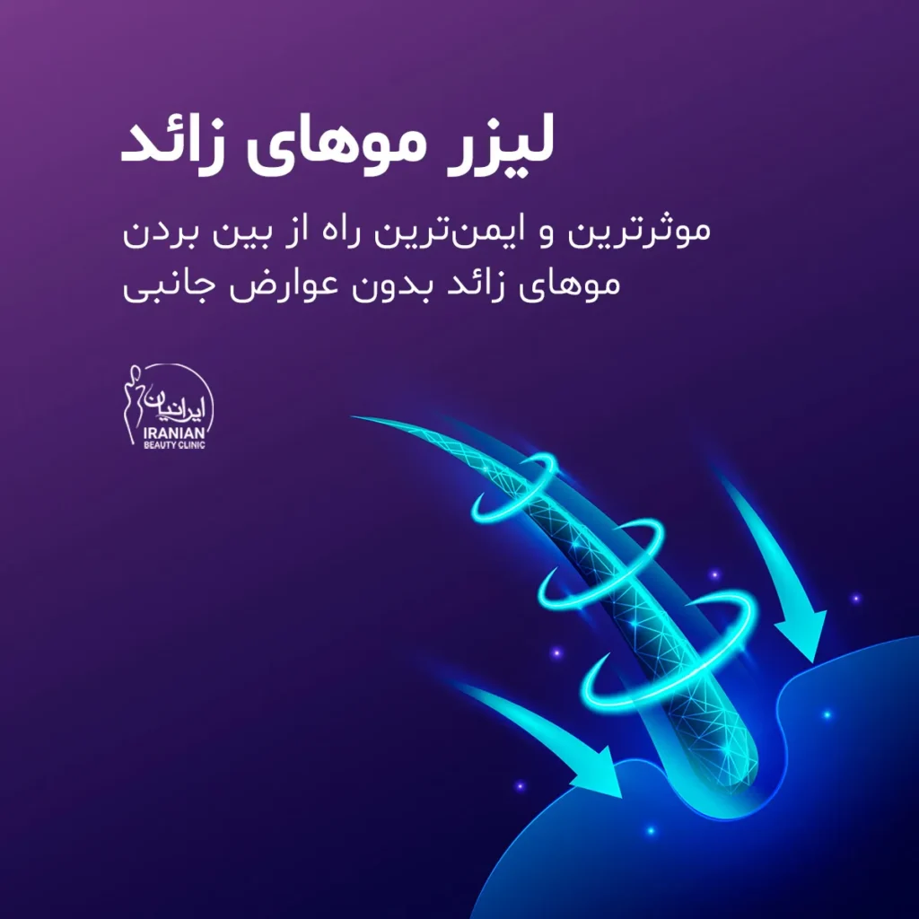 لیزر موهای زائد در کلینیک ایرانیان
