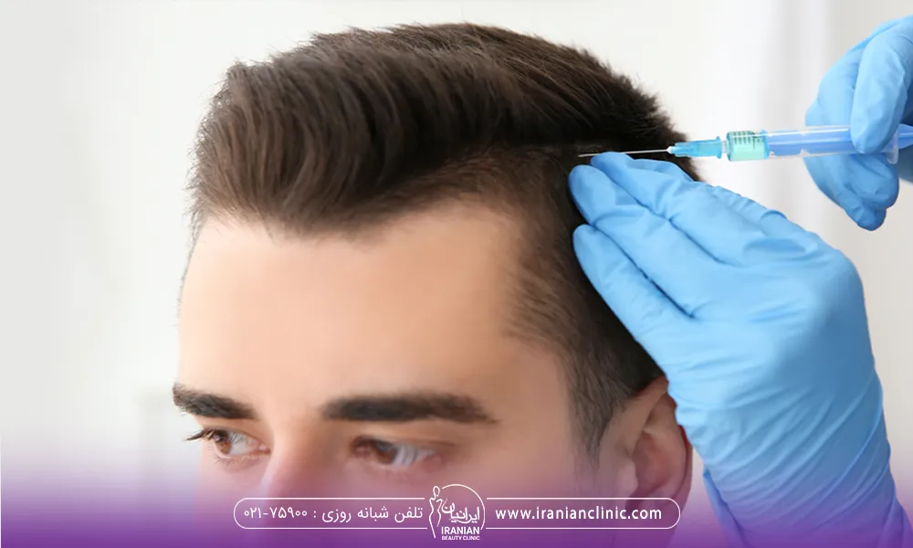 مردی که نشسته است و دستان دکتر با دستکش آبی که یک دست روی سر مرد زیر ناحیه تزریق و با یک دست در حال تزریق مزو در سر است