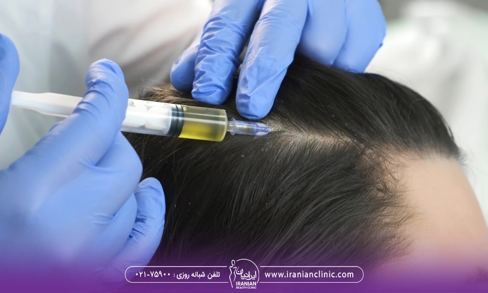 یک خانم در حال دریافت مزوتراپی مو