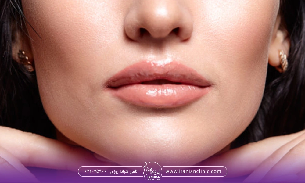 نصف صورت خانمی که پروتز چانه انجام داده است