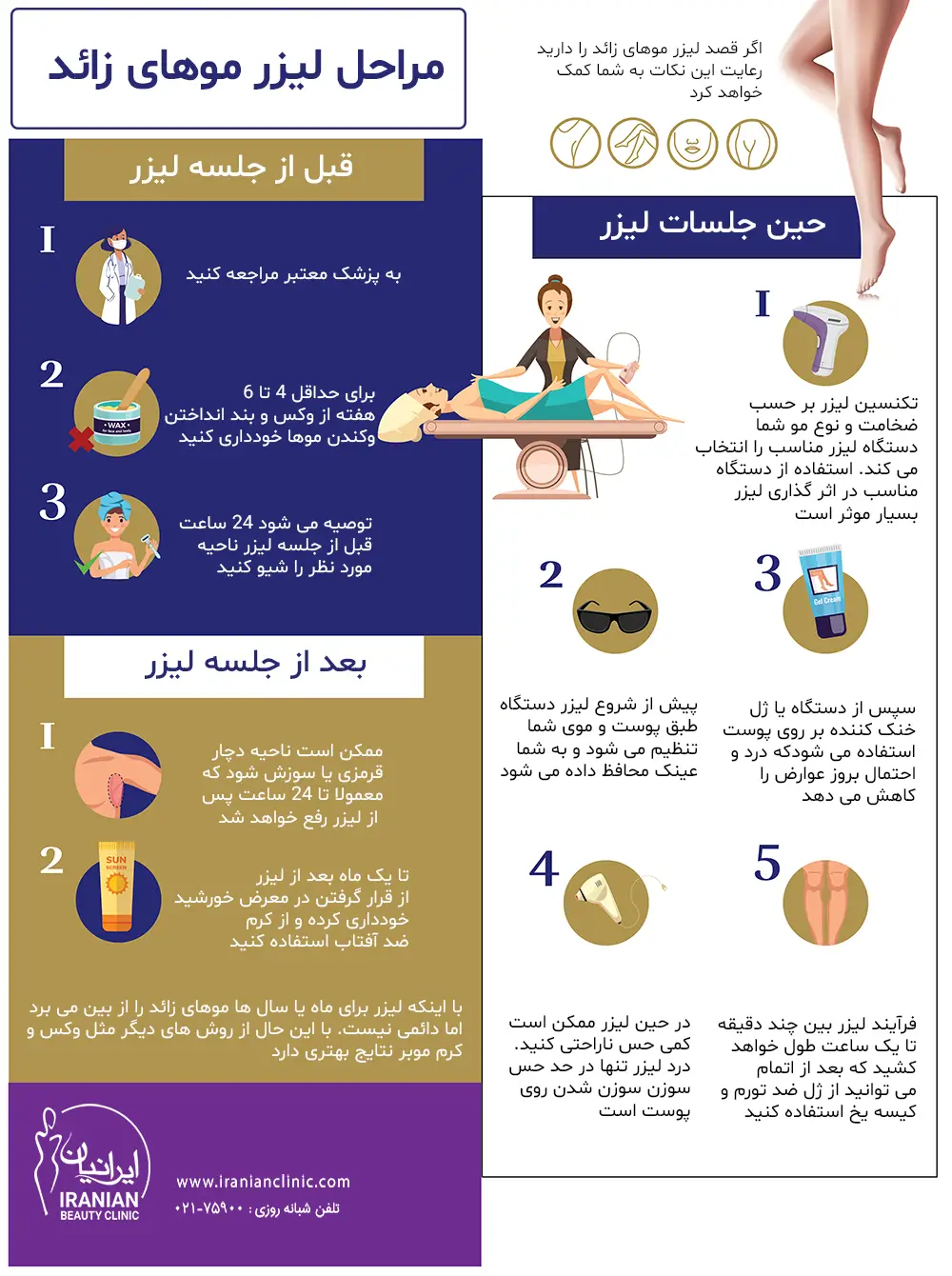 مراحل انجام لیزر موهای زائد به صورت قدم به قدم