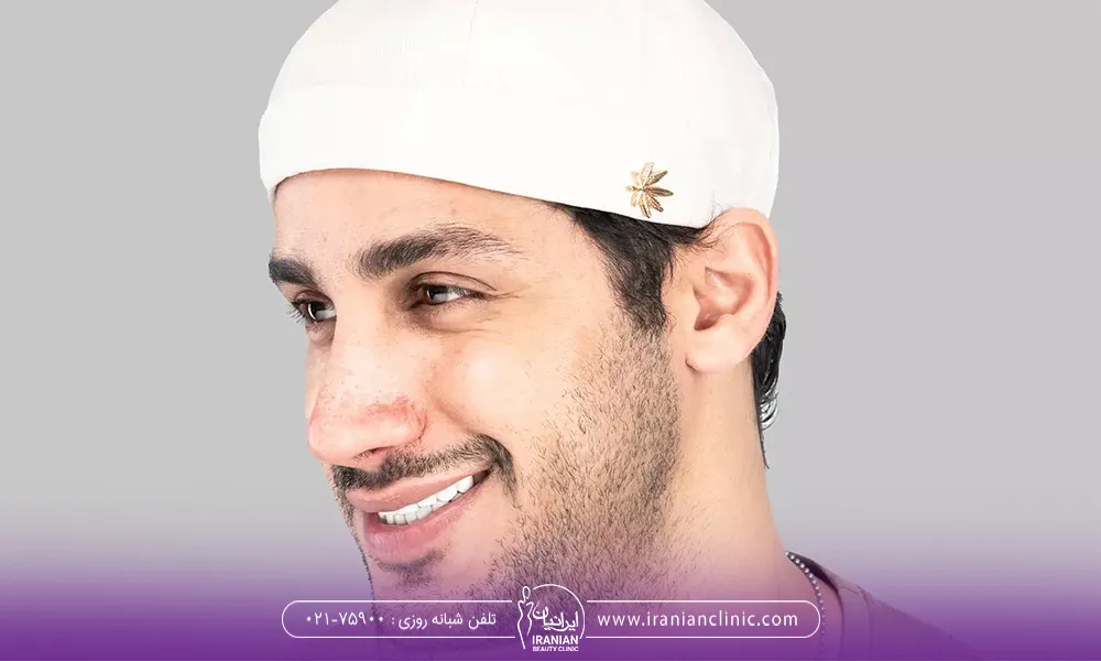 استفاده از کلاه