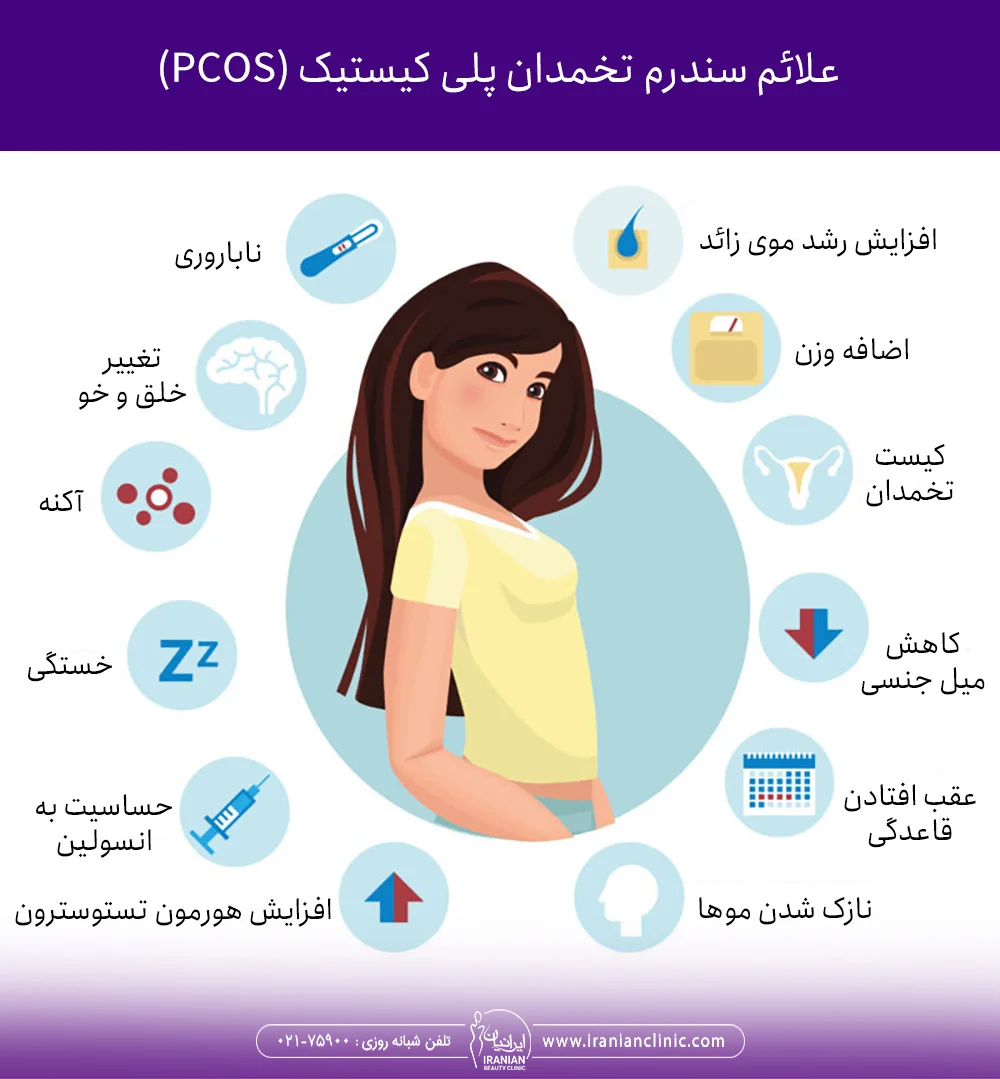 علام سندرم تخمدان پلی کیستیک