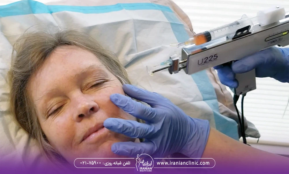 پزشک در حال پی آر پی صورت زن میانسال که روی تخت دراز کشیده است