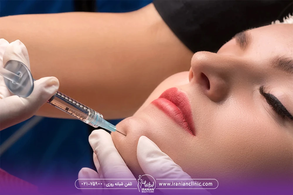 نحوه تزریق فیلر به چانه توسط پزشک زیبایی