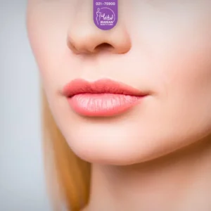 تصویر نزدیک از صورت دختری که گونه های برجسته دارد - لیفت نخ گونه