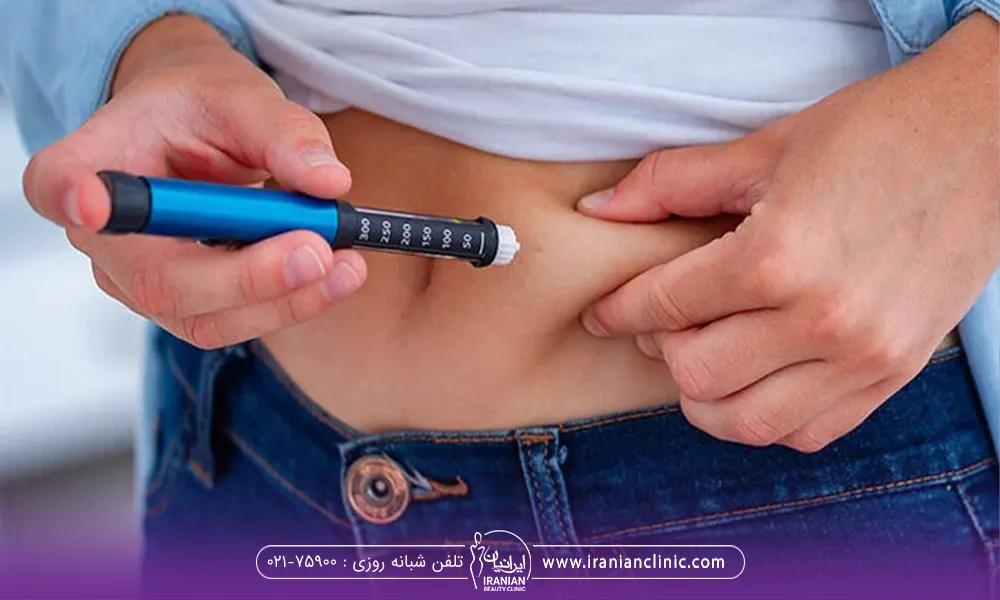 فردی که خودش در ناحیه شکم تزریق آمپول ماسیزا برای لاغری انجام میدهد