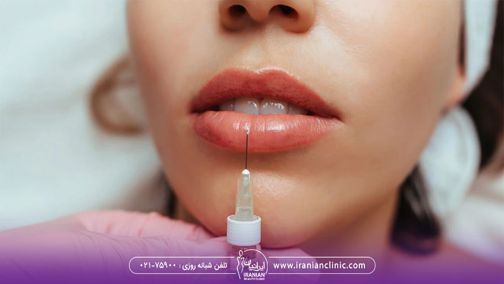 پزشکی که به لب پایین زن فیلر تزریق می کند