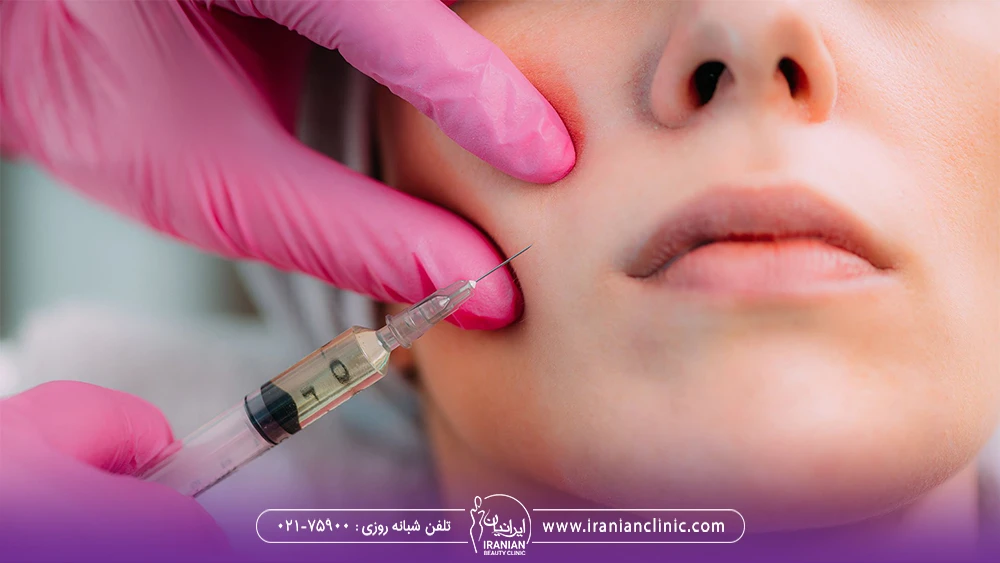 پزشک با دستکش های صورتی که به ناحیه خط لبخند زن ژل تزریق می کند - مراقبت های بعد از تزریق ژل