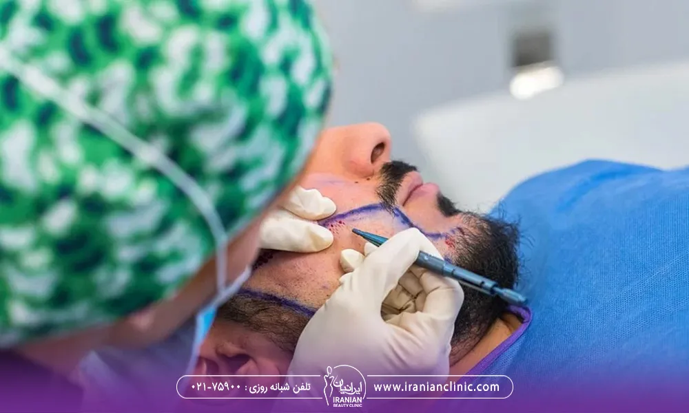 خانم دکتر رد حال انجام کاشت ریش برای آقا