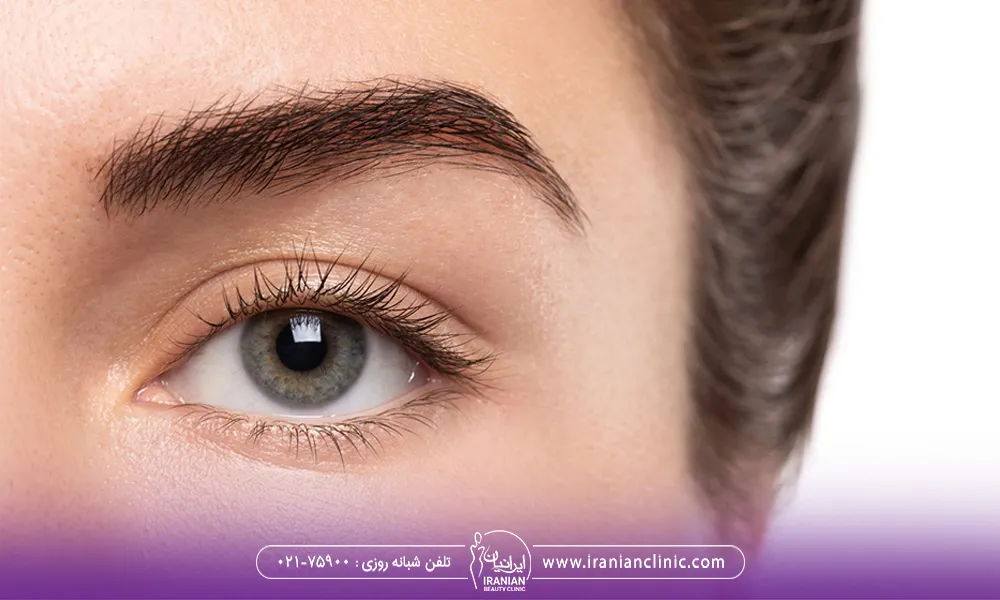 نیمه صورت یک خانم است که به فاصله بین چشم و ابرو اشاره دارد.