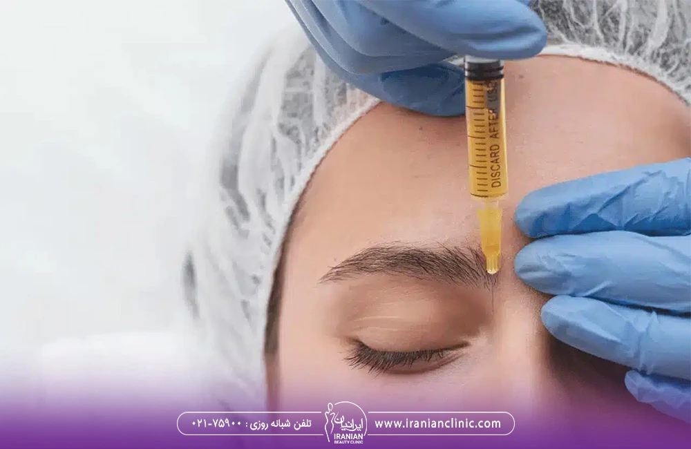 دستان پزشک که یک آمپول مزوتراپی در دست دارد و آمپول را بین ابروهای دختر تزریق می کند