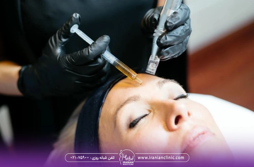 دکتری که پیشانی زن را مزونیدلینگ می کند