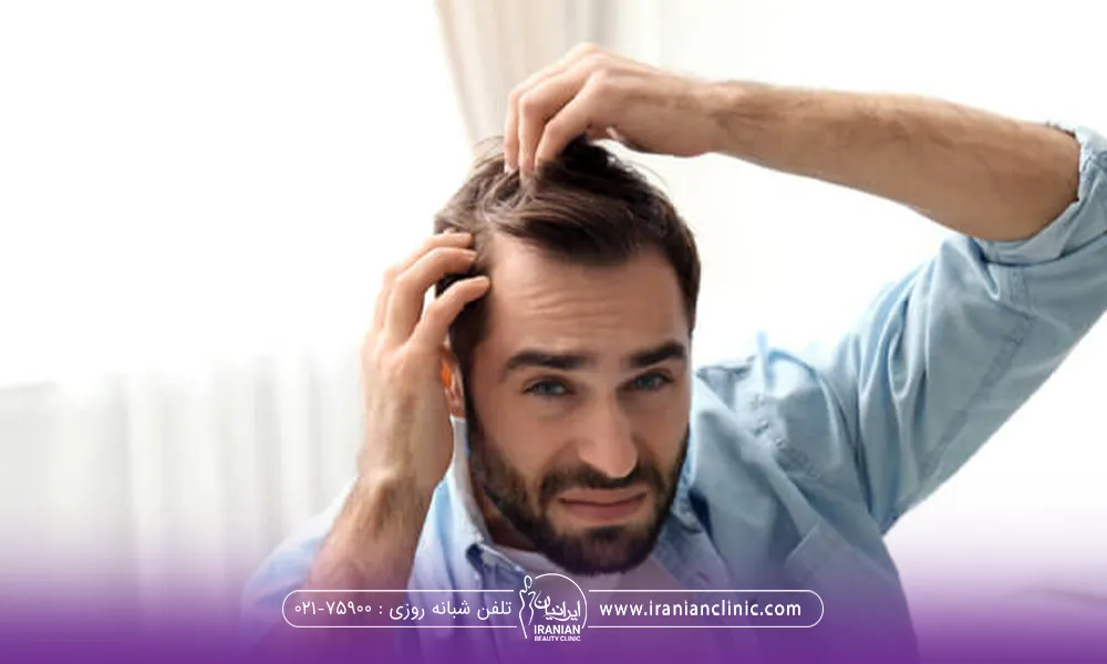 مردی که در آینه کم پشت شدن موهای شقیقه خود را نگاه می کند و از ریزش موی خود ناراضی است