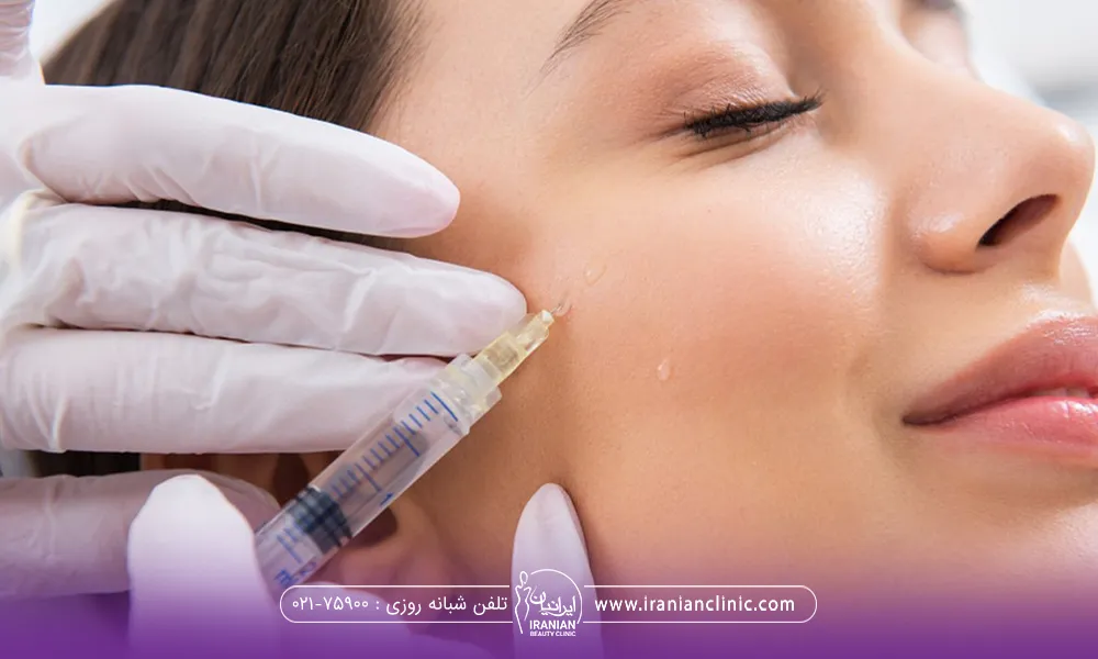 ماندگاری بوتاکس گونه چقدر است؟