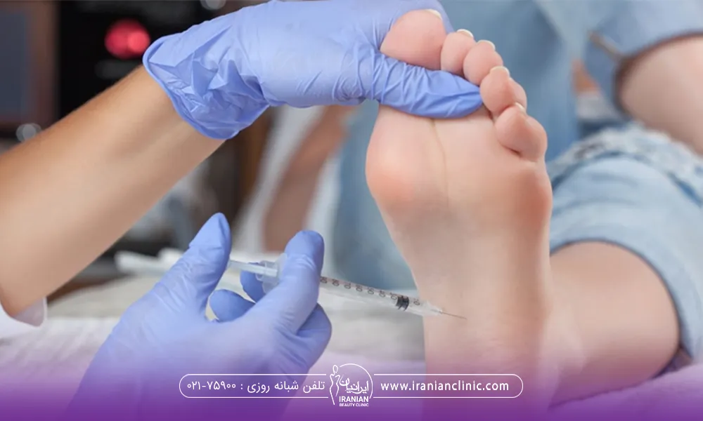 عوارض و نکات ایمنی بوتاکس رفع تعریق