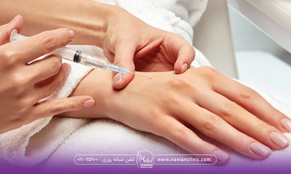 دکتری که به دست راست یک دختر مزوژل تزریق می کند - جوانسازی پوست دست
