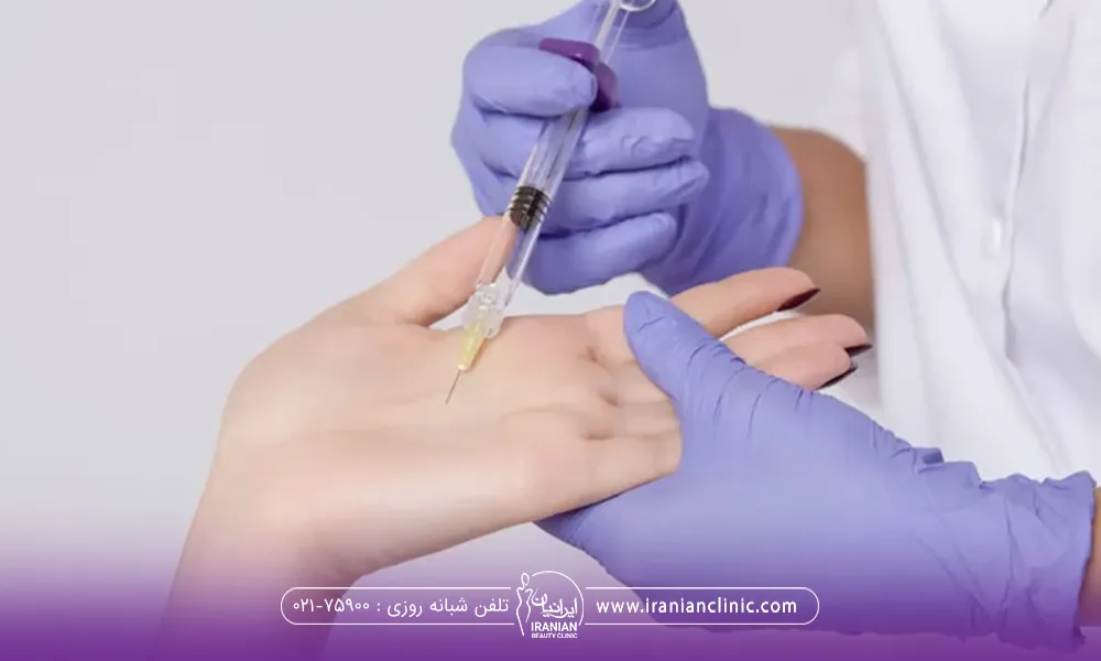 بوتاکس بیشتر در چه نواحی بدن برای تعریق استفاده می‌شود؟
