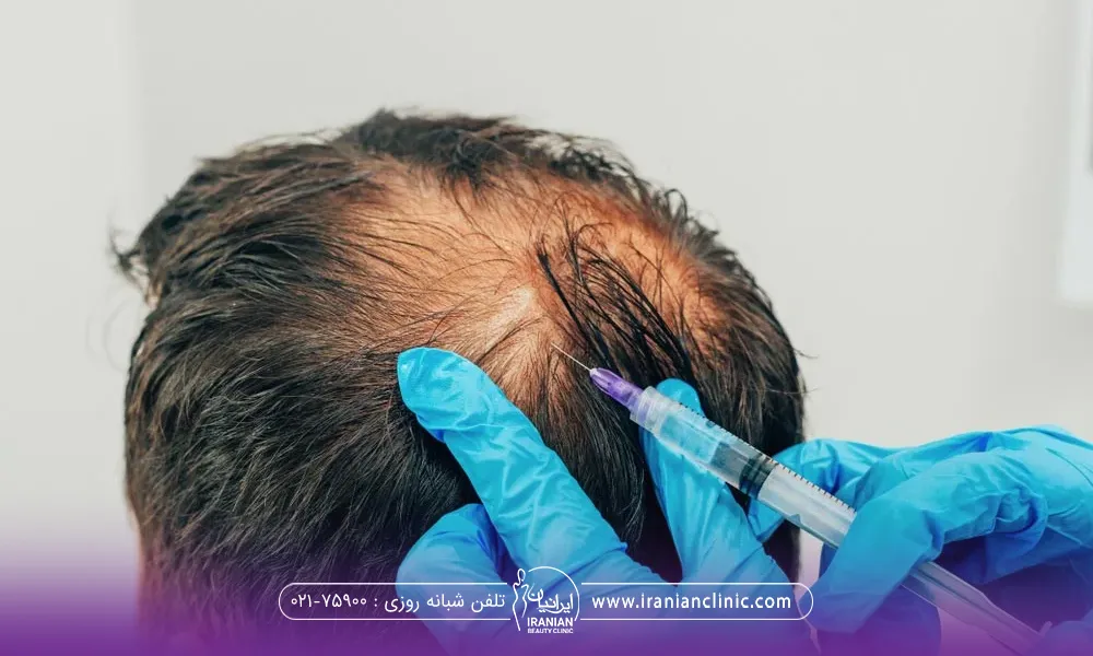 مردی که نشسته و دستان دکتر که دستکش ابی درد و در حال تزریق آمپول اگزوزوم به سر فرد است