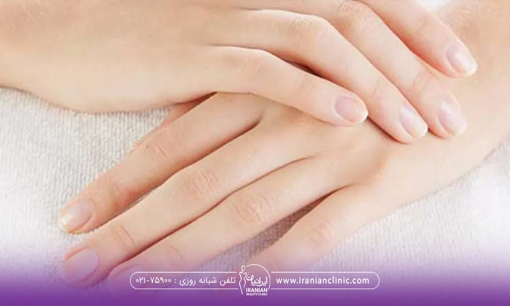 دستان فردی که دست های خود را روی هم گذاشته است