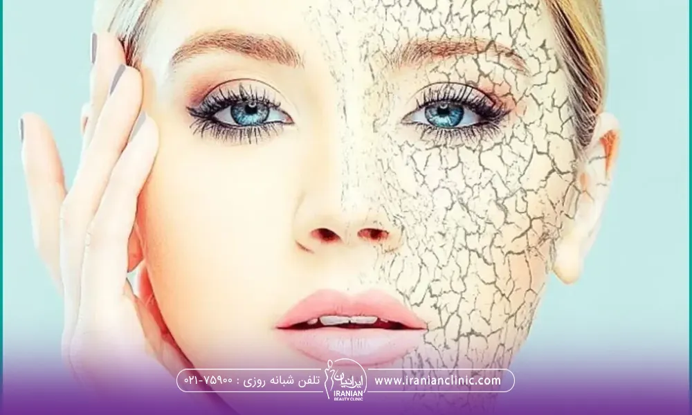 صورت خانمی که نصف صورتش ترک خورده و سمت دیگر جوان و شاداب است