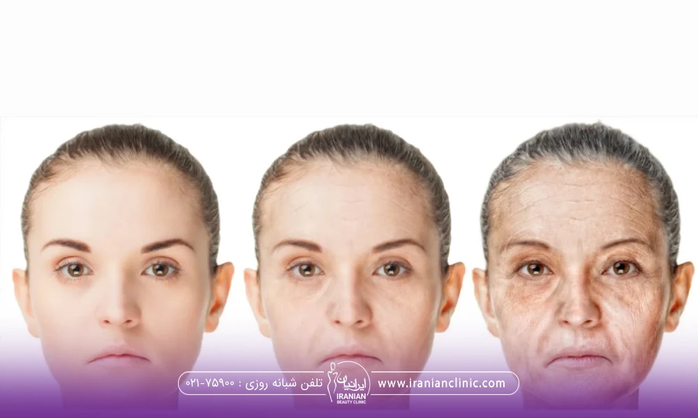 صورت خانمی که در سه مرحله پیر شدن است نشان داده است