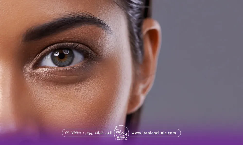 عکس از نیمه چپ صورت دختر با چشم طوسی و موی مشکی