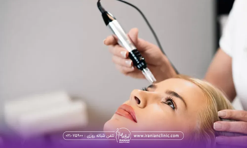 دختری که خوابیده و به سمت بالا نگاه میکند و دست اپراتوری که در حال میکرونیدلینگ پیشانی او است