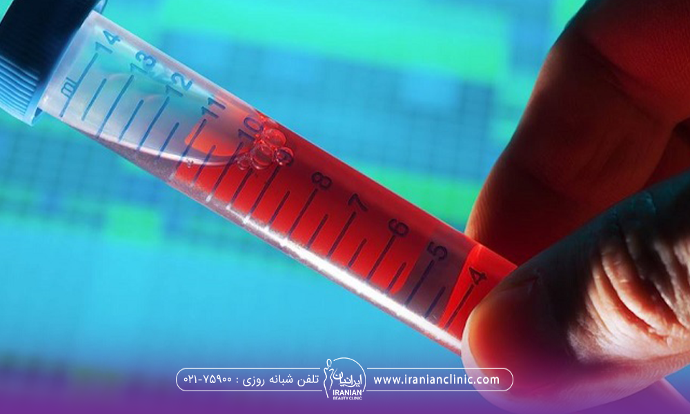 عکس نزدیک از دست فرد که یک شیشه حاوی خون گرفته شده در آزمایش خون را نگه داشته است