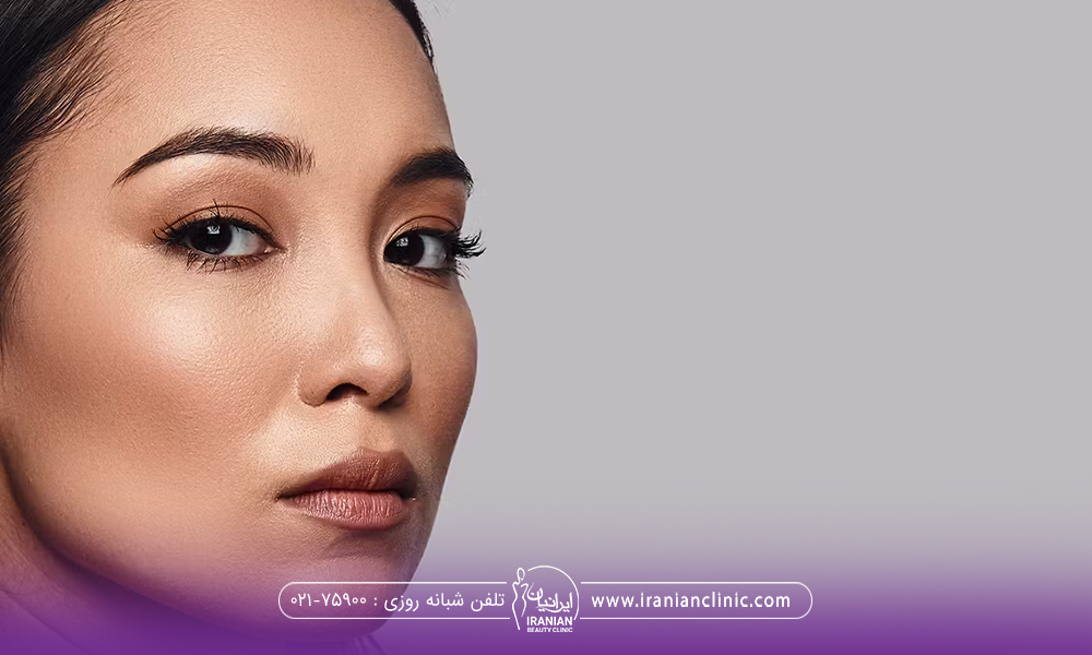 عکس دختری که گونه های برجسته و صورت زاویه دار دارد