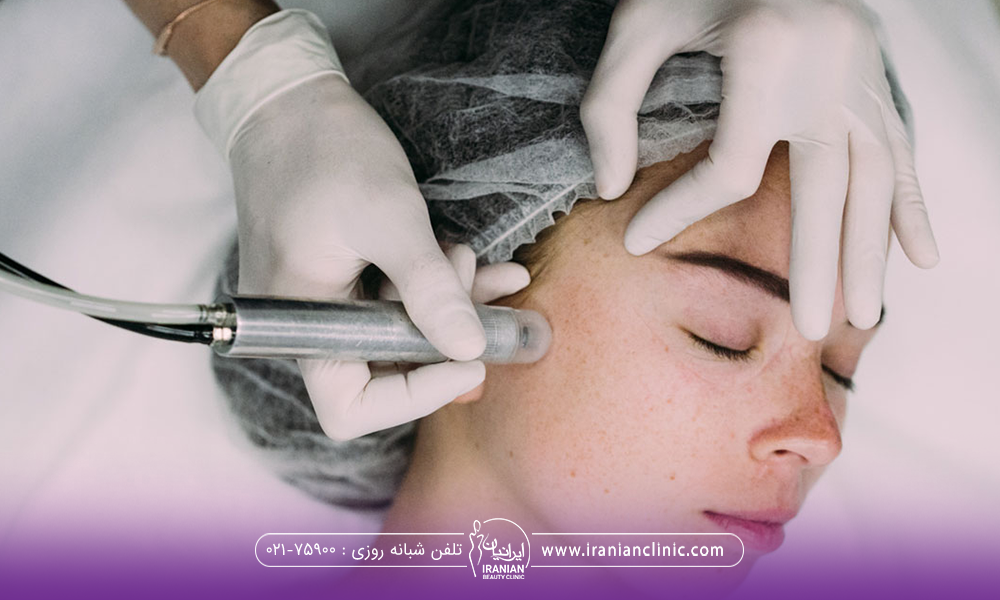 دستان دکتری که از بالای سر فرد در حال انجام میکرودرم ابریژن است و فردی که خوابیده و کلاه مخصوص به سر دارد