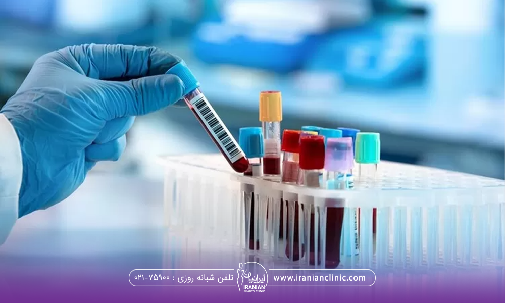 دست دکتری که دستکش آبی دارد و در حال یک نمونه خون از بین چند ویال است