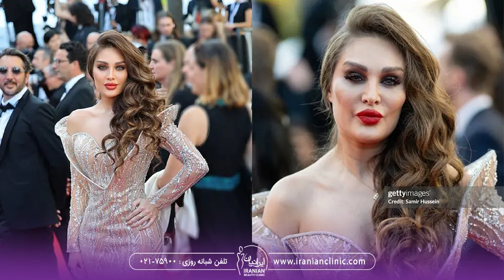 عکس واقعی و عکس ادیت شده در اینستاگرام طلا گلزار در جشنواره کن