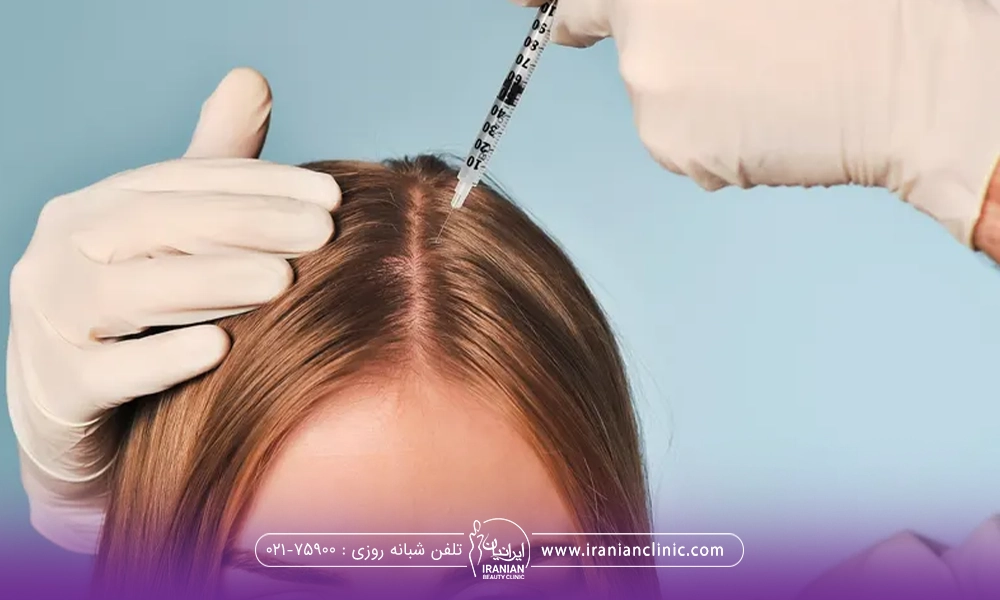 دستان دکتری که دستکش دارد و با یک دست سر دختر را گرفته و با دست دیگر در حال مزوتراپی مو است
