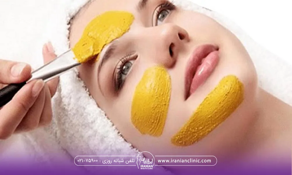 خانمی که خوابیده و دست فرد دیگری که در حال گذاشتن ماسک زردچوبه روی صورتش است