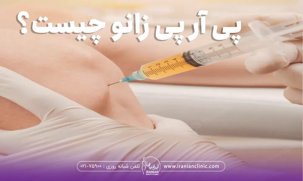 دستان دکتری که یک دست روی زانوی فرد است و دست دیگر در حال تزریق میباشد
