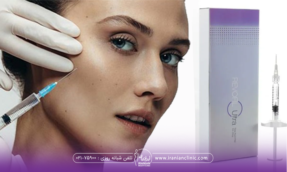 عکس جعبه ژل رووفیل بنفش در کنار صورت یک دختر که به گونه او فیلر تزریق می شود
