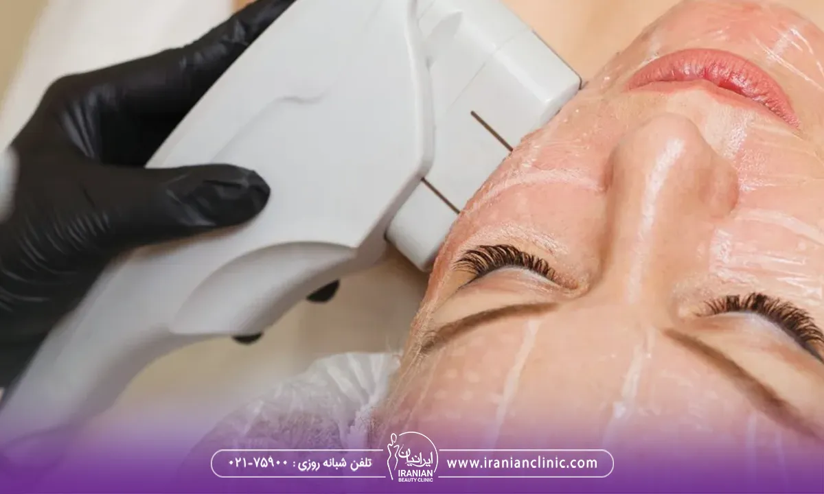 خانمی که هایفو لک صورت انجام می دهد، مراقبت های بعد از هایفوتراپی برای لک صورت