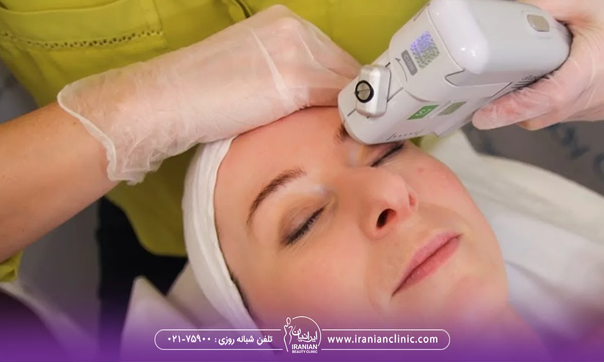 فواید هایفوتراپی برای صورت کدامند؟