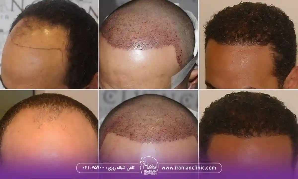 مراحل رشد مو بعد از کاشت و جدول مراحل رشد مو بعد از کاشت